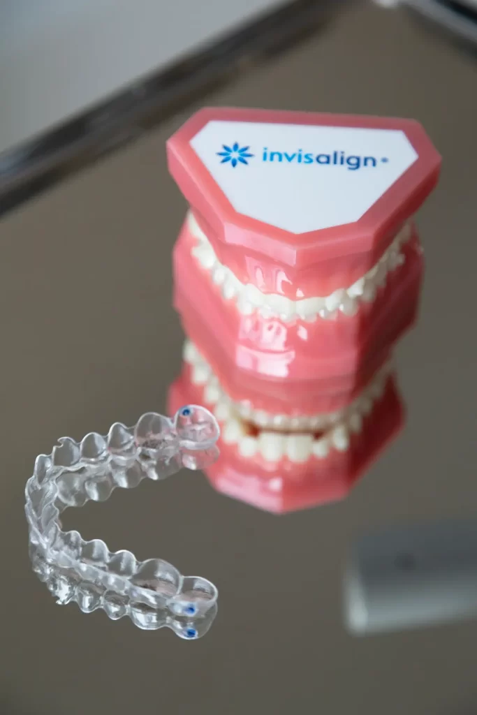 Prozirna Invisalign udlaga ispred modela čeljusti koji prikazuje ortodontsku terapiju.